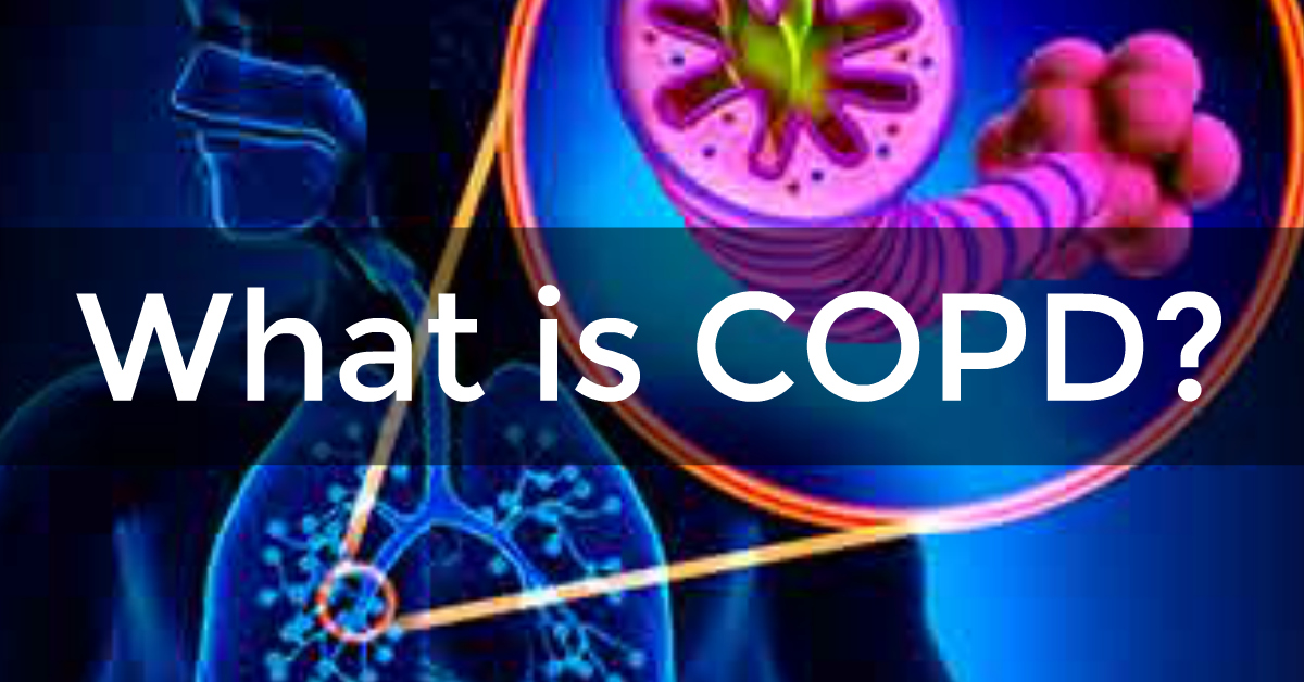 What Is Copd Caire Inc 